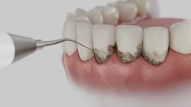Reliable Wisdom Tooth Removal contractor in Bennett County County, SD by Dentist Open Now